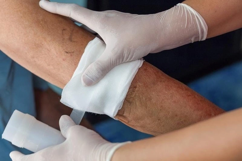 Dịch Vụ Chăm Sóc Vết Thương Tại Nhà Quận 6 - Điều dưỡng Nguyễn Thanh Thái Dương - 5
